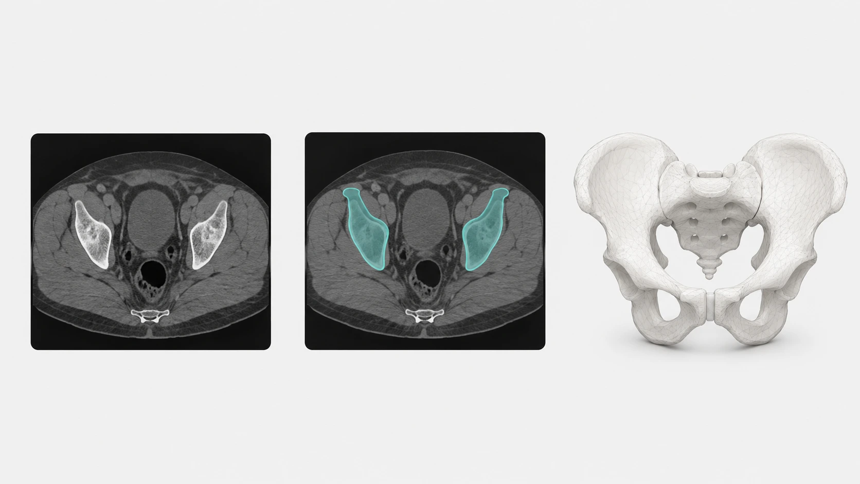 Medikal ve Dental Uygulamalarda 3D Baskı Rehberi 1 Tomografi kesitinden uc boyutlu modele uzanan veri hazirlik asamalari